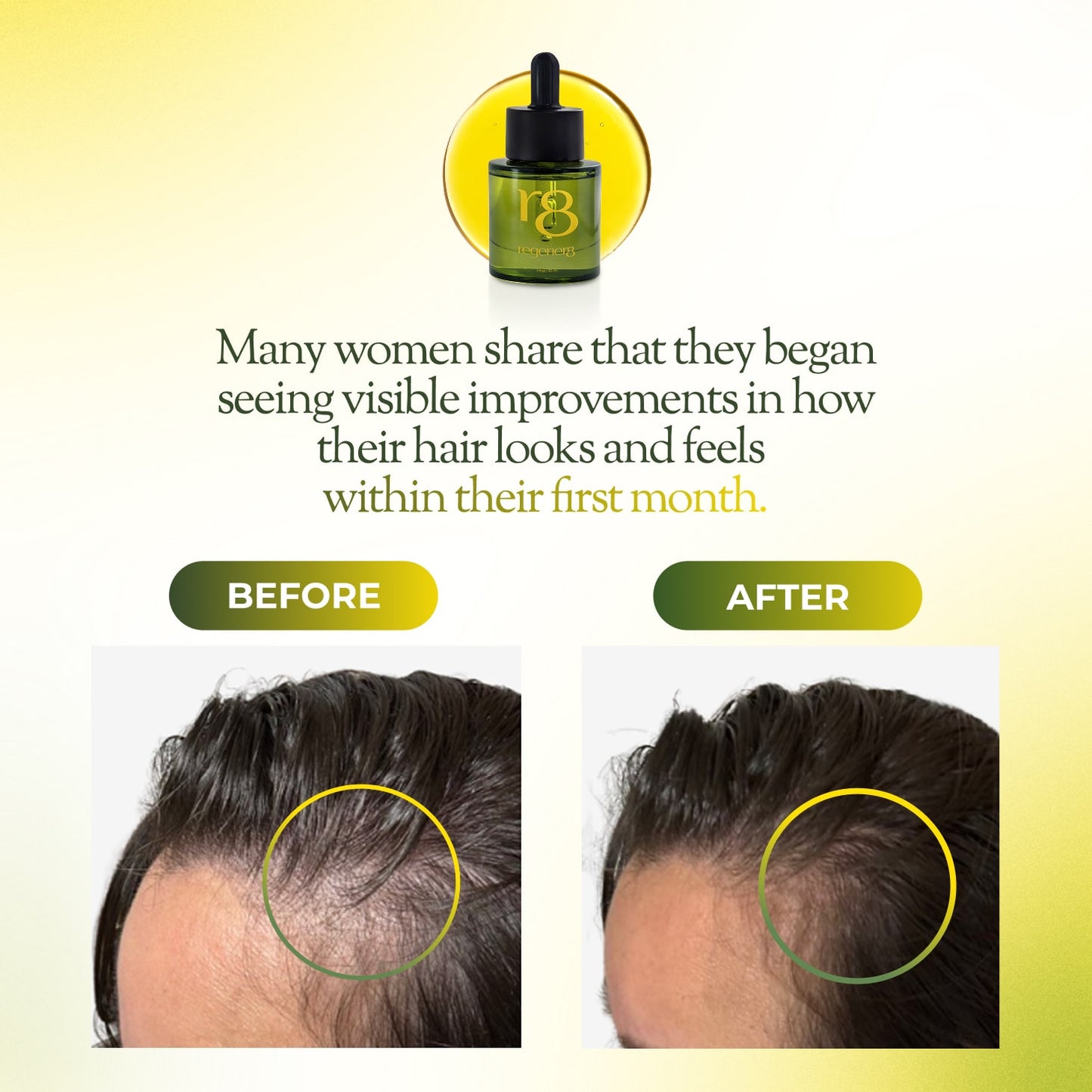 regener8 Essential & Carrier Oil Scalp System For Thinning Hair – 1 Month Supply