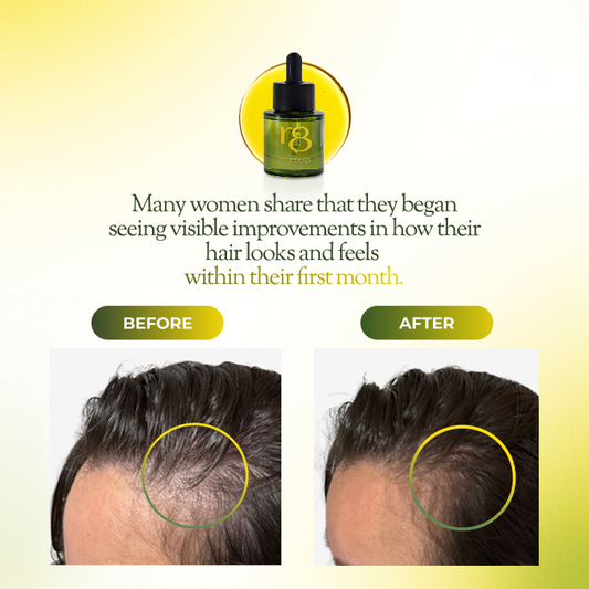 regener8 Essential & Carrier Oil Scalp System For Thinning Hair – 1 Month Supply