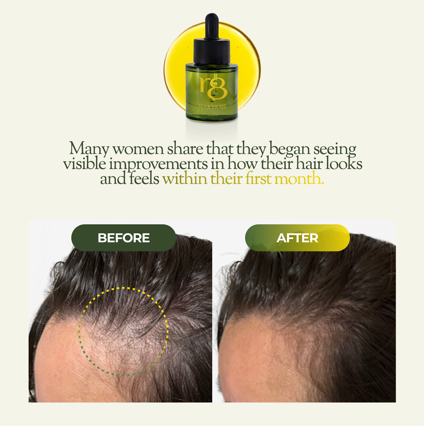 regener8 Essential & Carrier Oil Scalp System For Thinning Hair – 1 Month Supply
