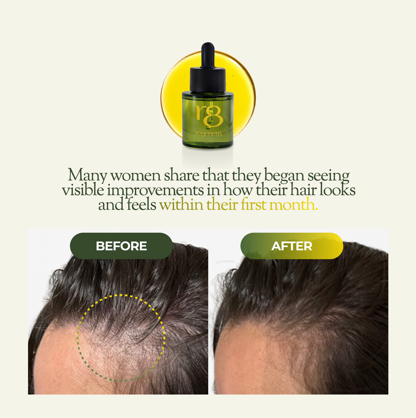 regener8 Essential & Carrier Oil Scalp System For Thinning Hair – 1 Month Supply